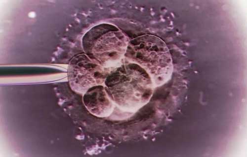 卵巢不好的鲜胚适合养囊吗？囊胚更符合子宫生理状态！